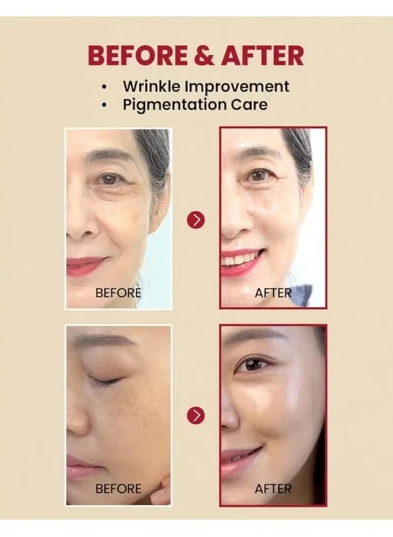 K-SECRET KSECRET SEOUL 1988 Serum : Retinal Liposome 2% + Black Ginseng, 30ml/1.01fl.oz | 58% Black Ginseng Extract with Retinal, Bakuchiol, Vitamin C & 3 Peptides for Wrinkle Care | Korean Skincare - Image 5